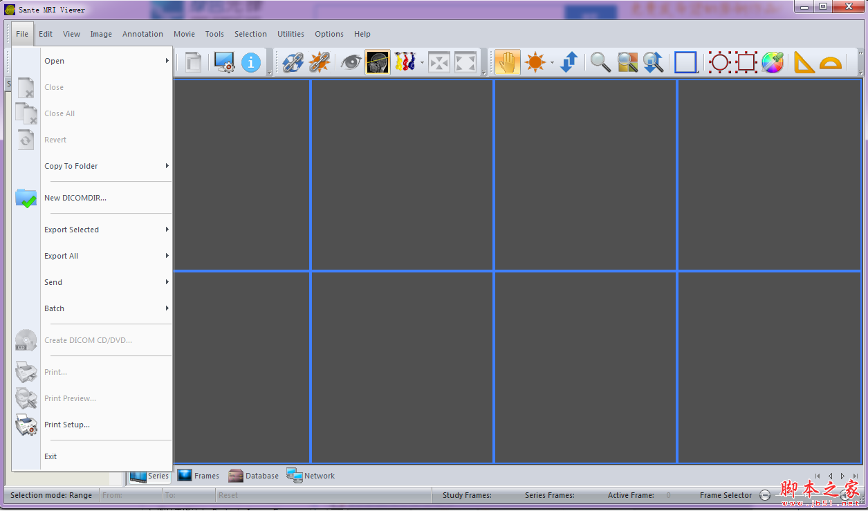 Sante MRI Viewer(核磁共振图像浏览器) V3.1 免费安装版